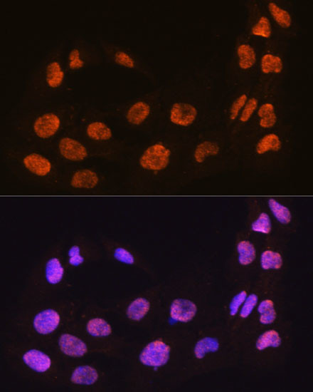 MAML2 Antibody in Immunocytochemistry (ICC/IF)