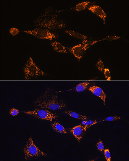 PDE12 Antibody in Immunocytochemistry (ICC/IF)