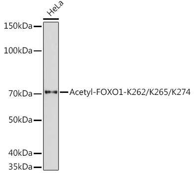 Acetyl-FOXO1 (Lys262, Lys265, Lys274) Antibody in Western Blot (WB)