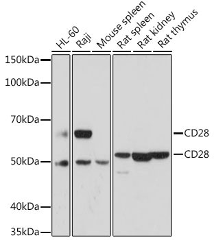 CD28 Antibody in Western Blot (WB)