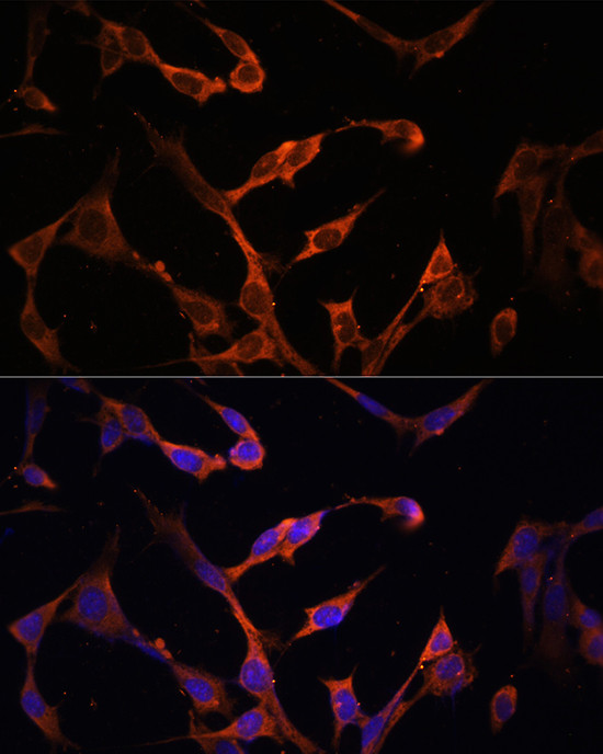 HLA-DPB1 Antibody in Immunocytochemistry (ICC/IF)