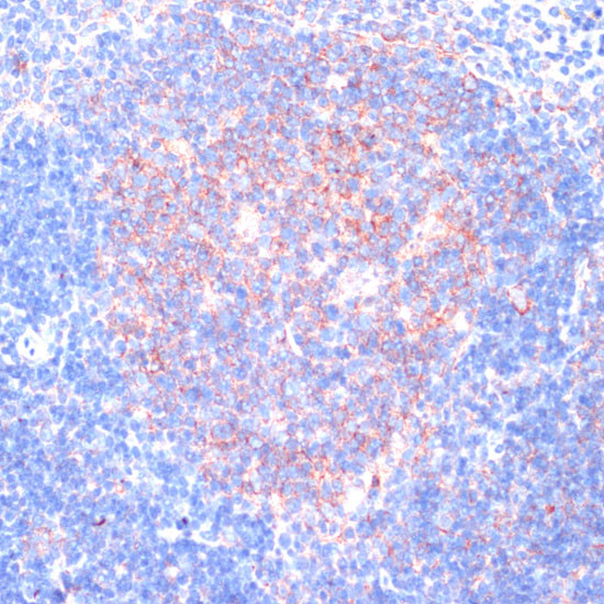 RPL31 Antibody in Immunohistochemistry (Paraffin) (IHC (P))