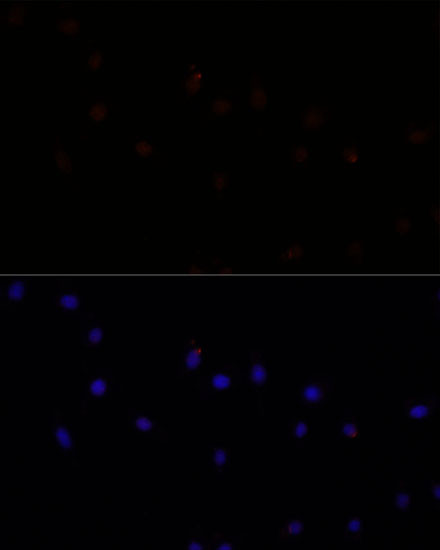 Calpain 7 Antibody in Immunocytochemistry (ICC/IF)