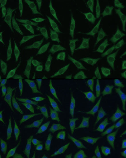 SUMF2 Antibody in Immunocytochemistry (ICC/IF)