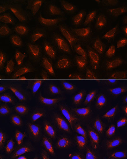 MRPL43 Antibody in Immunocytochemistry (ICC/IF)