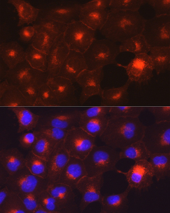 Axl Antibody in Immunocytochemistry (ICC/IF)