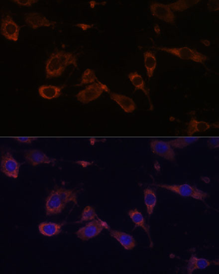 MT-ATP6 Antibody in Immunocytochemistry (ICC/IF)