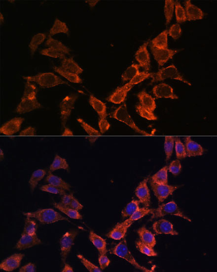 MT-ND4 Antibody in Immunocytochemistry (ICC/IF)