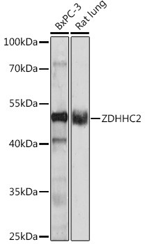 ZDHHC2 Antibody in Western Blot (WB)