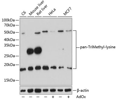 Tri-Methyl Lysine Antibody in Western Blot (WB)