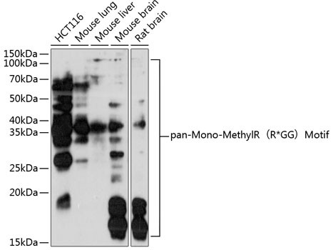 Mono-Methyl Arginine Antibody in Western Blot (WB)
