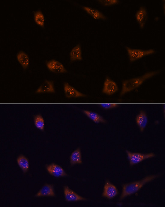 DIP2C Antibody in Immunocytochemistry (ICC/IF)