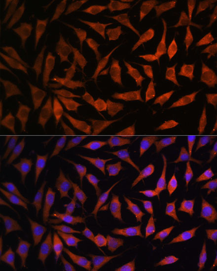 RPS8 Antibody in Immunocytochemistry (ICC/IF)