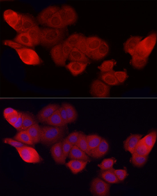 CD47 Antibody in Immunocytochemistry (ICC/IF)