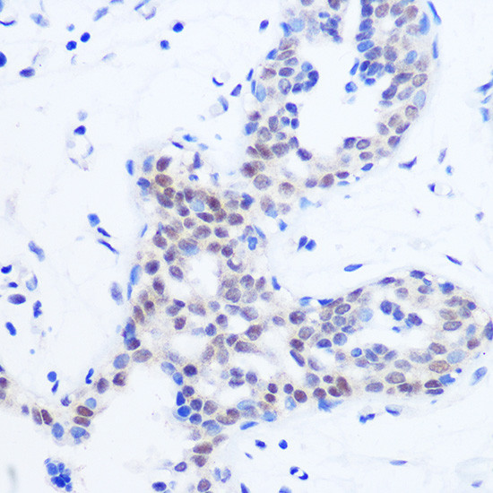 SRSF11 Antibody in Immunohistochemistry (Paraffin) (IHC (P))