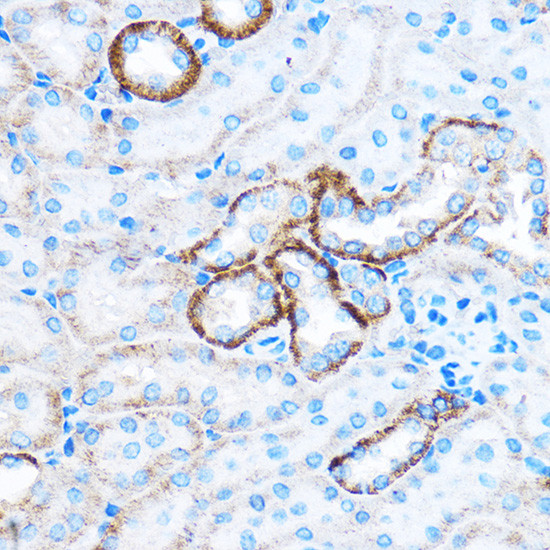 CABP1 Antibody in Immunohistochemistry (Paraffin) (IHC (P))