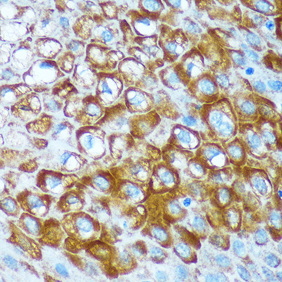 RCE1 Antibody in Immunohistochemistry (Paraffin) (IHC (P))