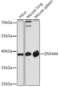 ZNF444 Antibody in Western Blot (WB)