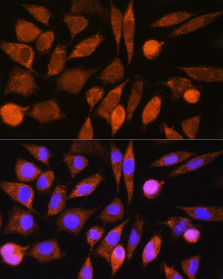 CHCHD7 Antibody in Immunocytochemistry (ICC/IF)