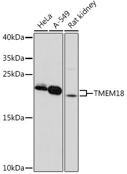 TMEM18 Antibody in Western Blot (WB)
