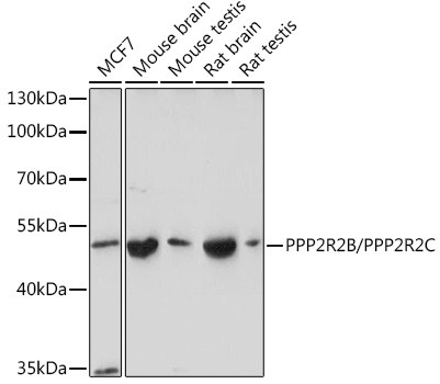 PPP2R2B/PPP2R2C Antibody in Western Blot (WB)