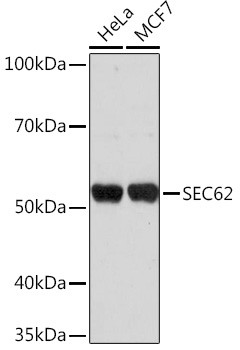 SEC62 Antibody in Western Blot (WB)
