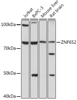 ZNF652 Antibody in Western Blot (WB)
