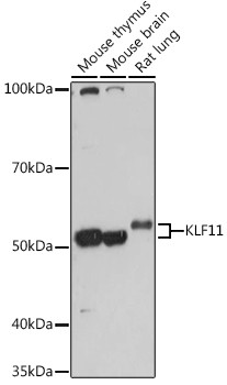 KLF11 Antibody in Western Blot (WB)