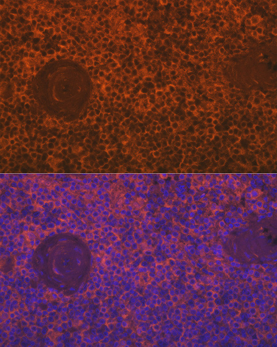 SIGLEC15 Antibody in Immunocytochemistry (ICC/IF)