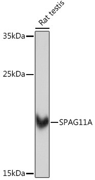 SPAG11A Antibody in Western Blot (WB)