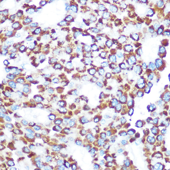 TAB3 Antibody in Immunohistochemistry (Paraffin) (IHC (P))