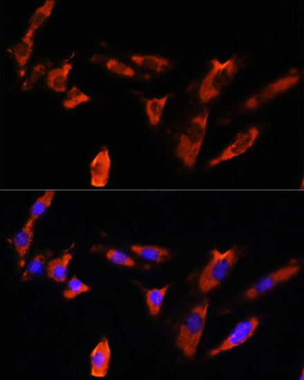 CDH8 Antibody in Immunocytochemistry (ICC/IF)