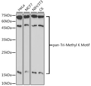 Tri-Methyl Lysine Antibody in Western Blot (WB)