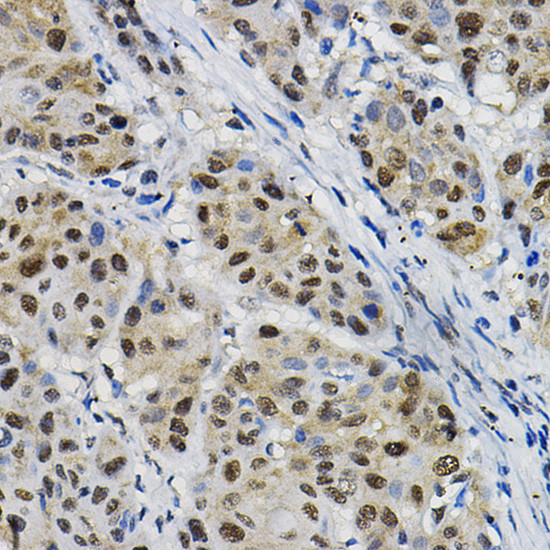 DNAJC17 Antibody in Immunohistochemistry (Paraffin) (IHC (P))