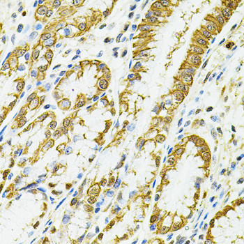 HLA-DQA1 Antibody in Immunohistochemistry (Paraffin) (IHC (P))