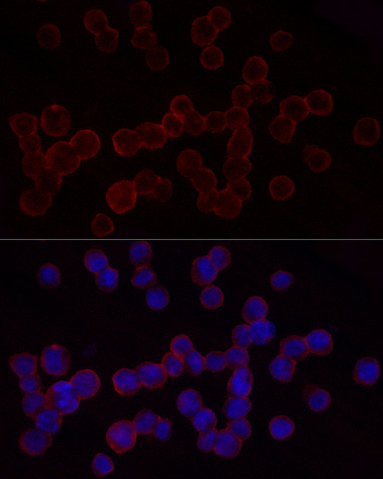 CD18 Antibody in Immunocytochemistry (ICC/IF)