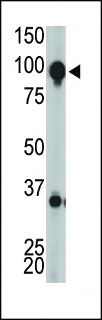 mGluR8 Antibody in Western Blot (WB)