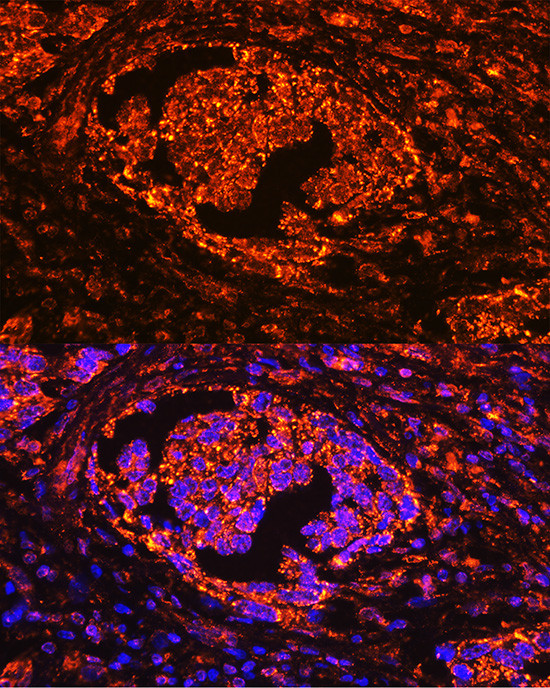 Tartrate Resistant Acid Phosphatase Antibody in Immunohistochemistry (Paraffin) (IHC (P))