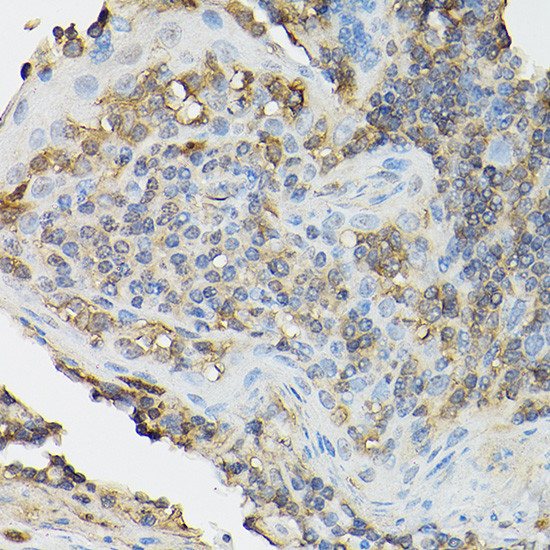 CD25 Antibody in Immunohistochemistry (Paraffin) (IHC (P))