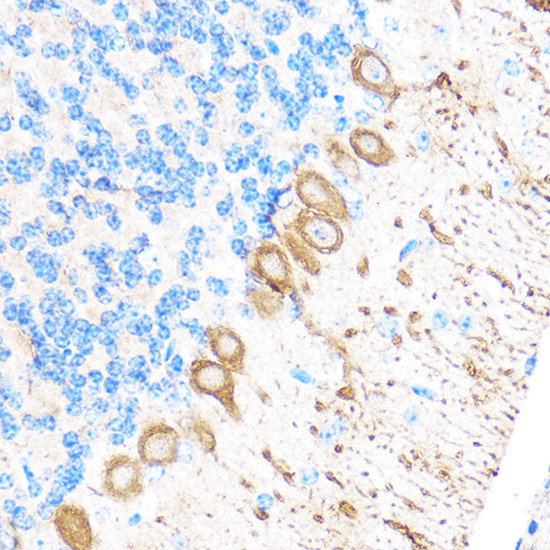 MMP17 Antibody in Immunohistochemistry (Paraffin) (IHC (P))