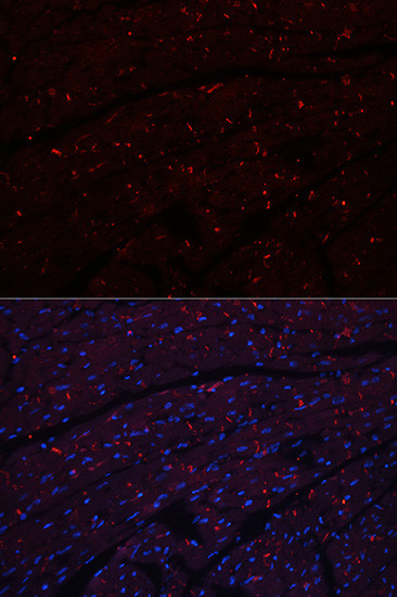 N-cadherin Antibody in Immunohistochemistry (Paraffin) (IHC (P))