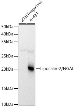 NGAL Antibody in Western Blot (WB)