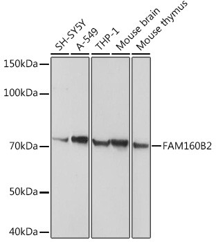RAI16 Antibody in Western Blot (WB)
