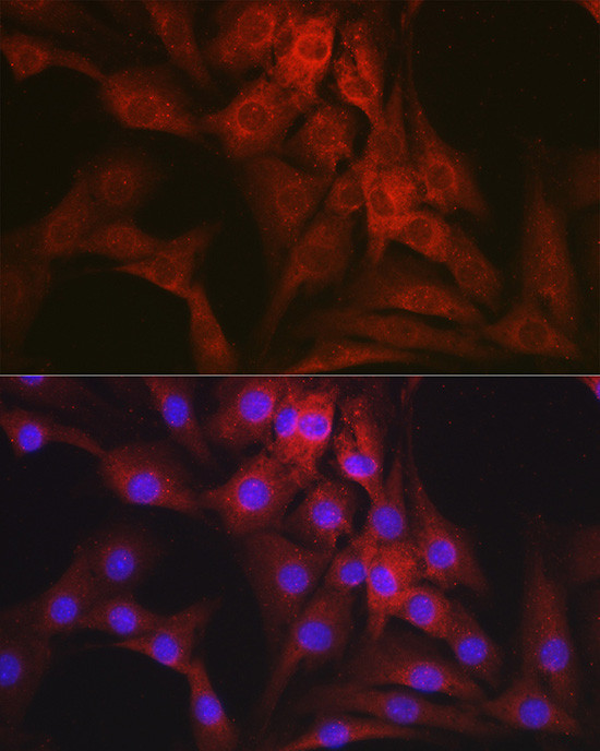NR3C2 Antibody in Immunocytochemistry (ICC/IF)