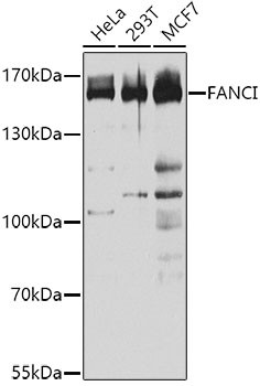 FANCI Antibody in Western Blot (WB)