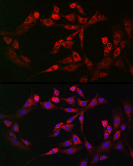 PIEZO1 Antibody in Immunocytochemistry (ICC/IF)