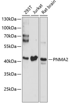 MA2 Antibody in Western Blot (WB)