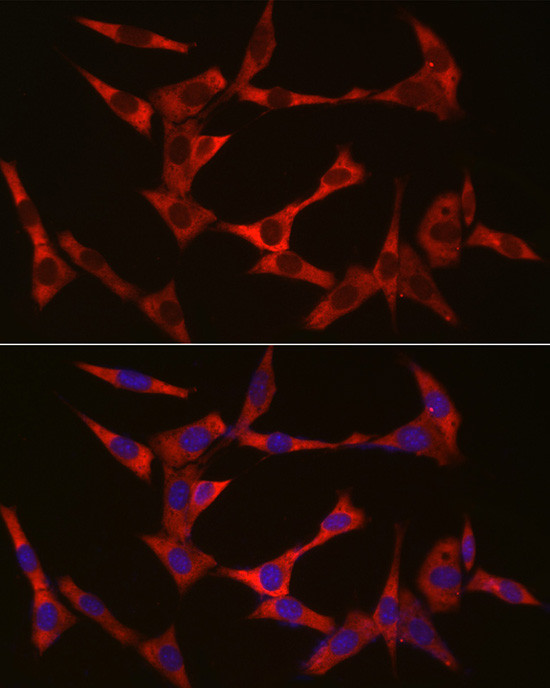 WIF1 Antibody in Immunocytochemistry (ICC/IF)