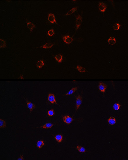 APLP2 Antibody in Immunocytochemistry (ICC/IF)