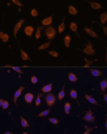 HIF1AN Antibody in Immunocytochemistry (ICC/IF)